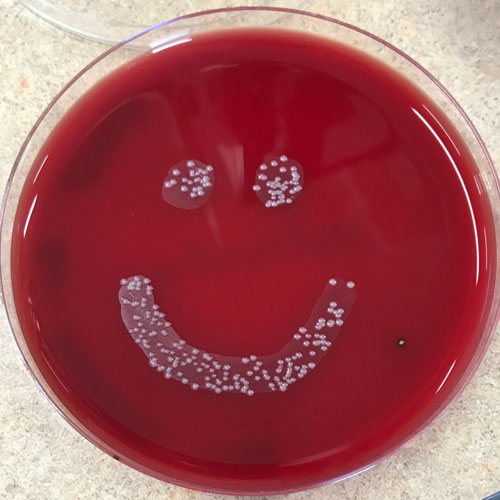 Petri dish with red material and bacteria in a smiley face